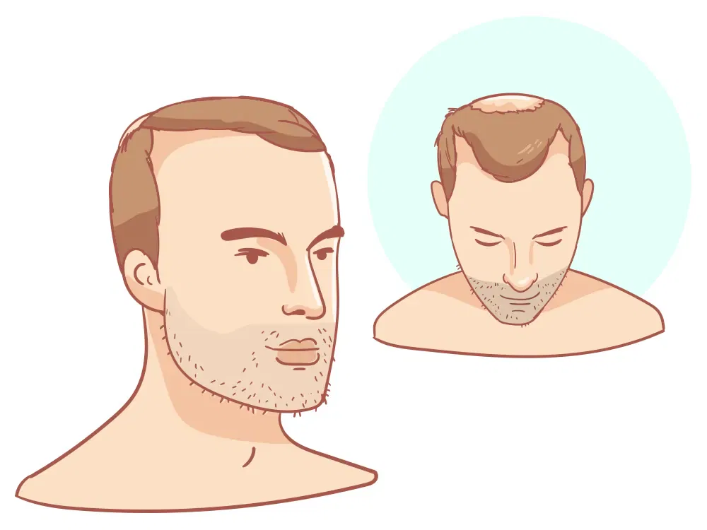 Отступающая линия волос Сильная + корона