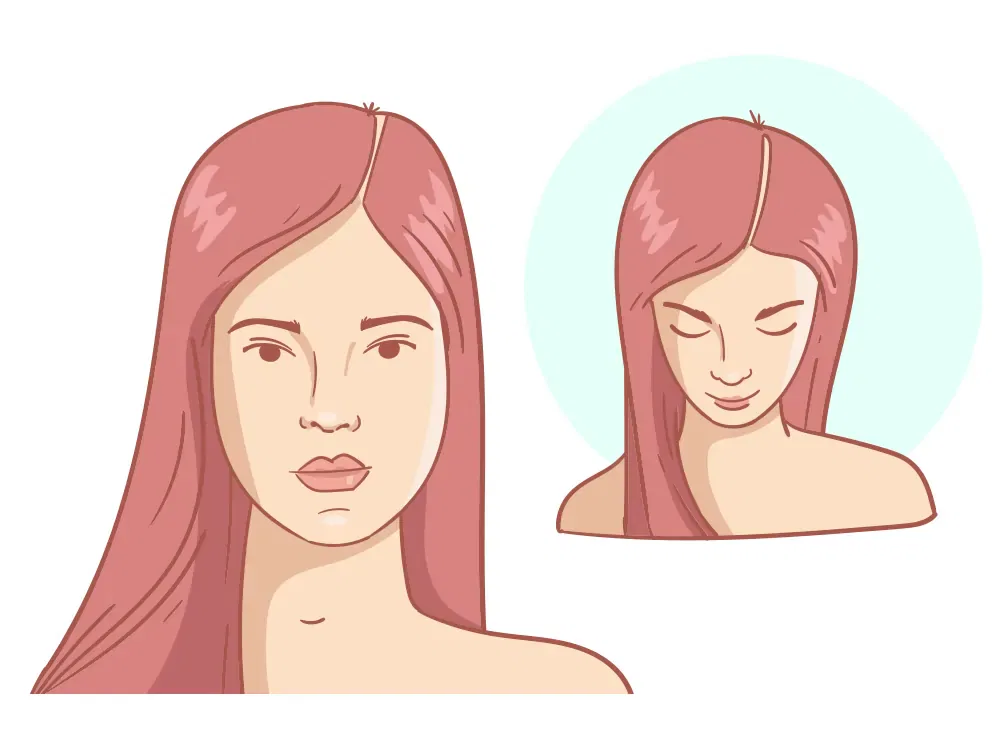 Редеющая линия волос