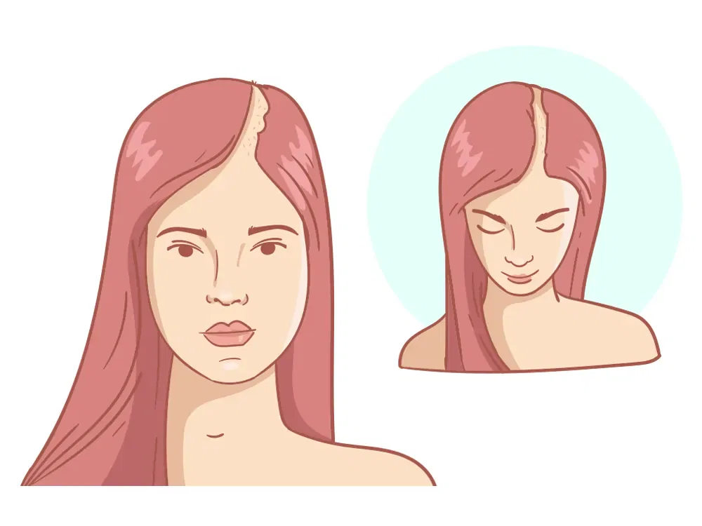 Отступающая линия волос Сильная + корона